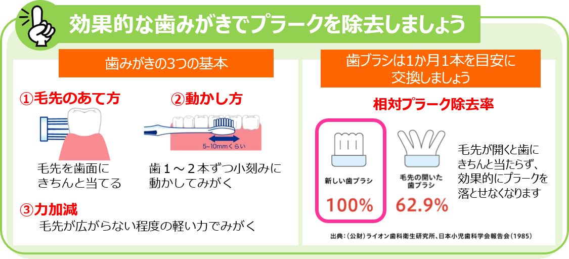 効果的な歯みがきでプラークを除去しましょう